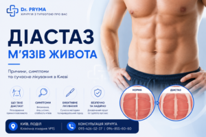 Діастаз