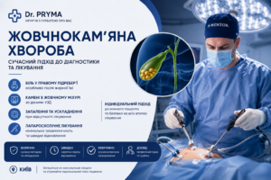 Жовчнокам’яна хвороба: симптоми, причини та сучасне лікування
